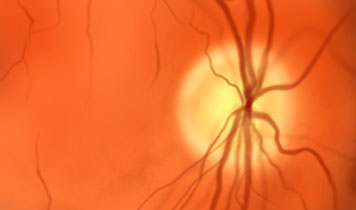 Le nerf optique, cet inconnu